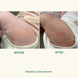 BEETL Baby Cream - 250ml