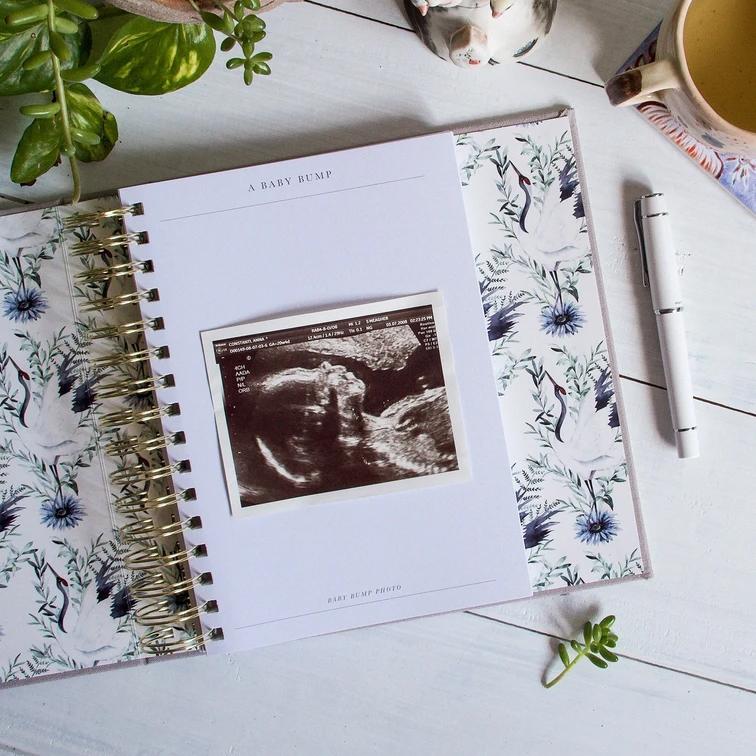 Bump (My Pregnancy Journal)